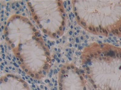 FBN3 Antibody
