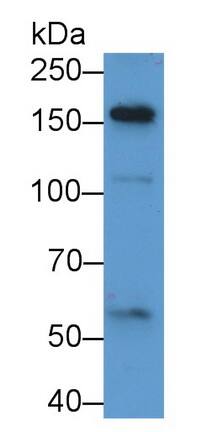 alpha 2-Macroglobulin-like 1/A2ML1 Antibody