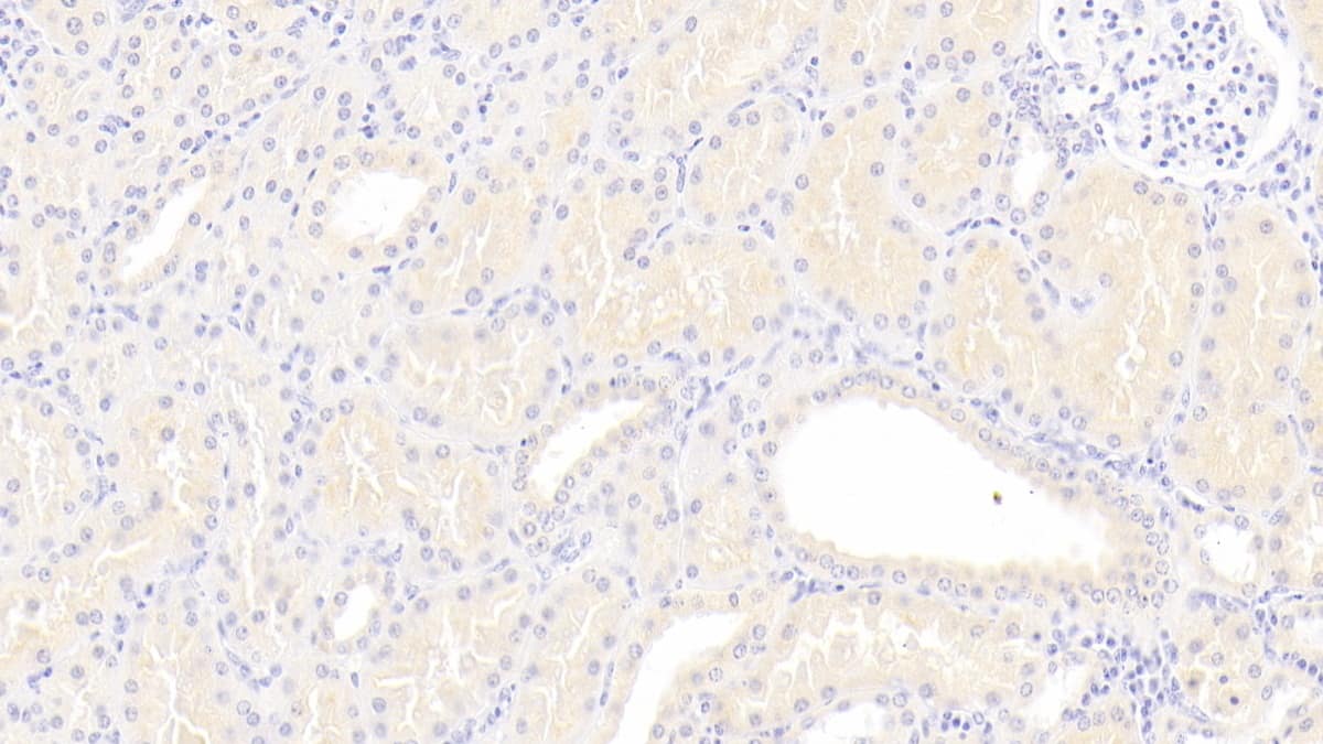 Lipoprotein a Antibody