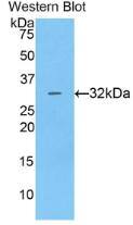 Cathepsin V Antibody