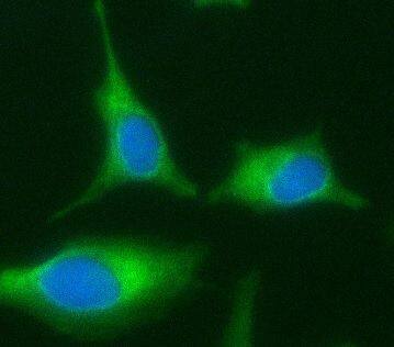 ABCD1 Antibody (9D11)