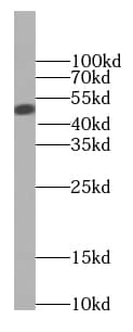 BCS1L Antibody (9G10)