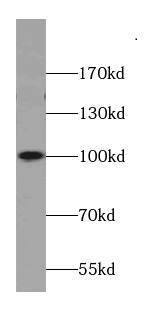 AKAP3 Antibody (0B8)