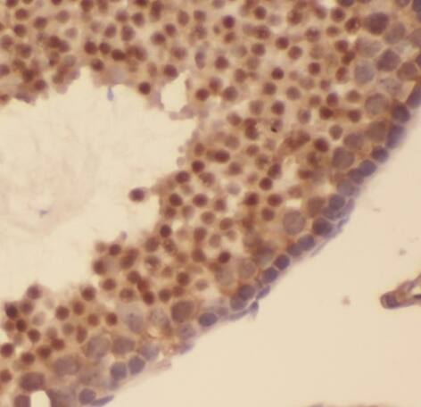 AKAP3 Antibody (0B8)