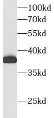Aldolase C Antibody (6F3)
