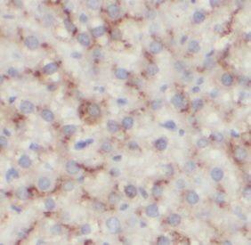 Aldolase C Antibody (6F3)