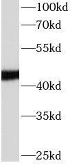 Apolipoprotein L1 Antibody (5E2)