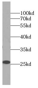 D4-GDI/RhoGDI2 Antibody (5A6)