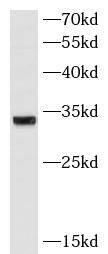 ATPG Antibody (8H11)