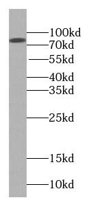 BBS2 Antibody (9F10)