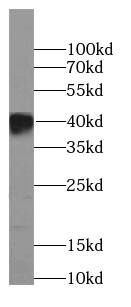 BBS5 Antibody (7E11)