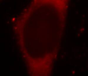 BORIS Antibody (2B10)