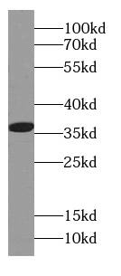 CAPZA1 Antibody (2C8)