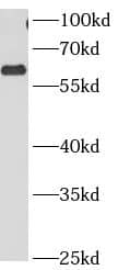 CCT3 Antibody (8C8)