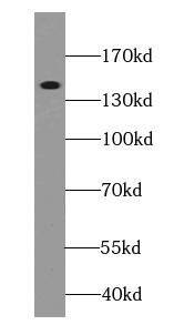 Ceruloplasmin Antibody (8F3)