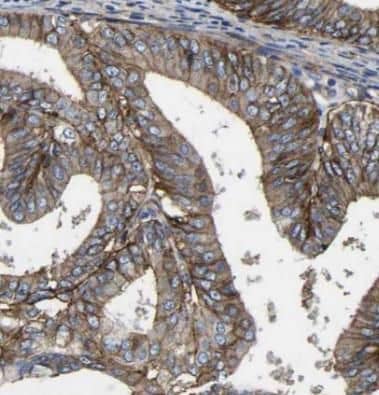 Ceruloplasmin Antibody (8F3)