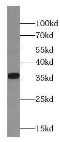 Calponin 2 Antibody (4C9)