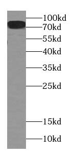 CPT1C Antibody (4E4)