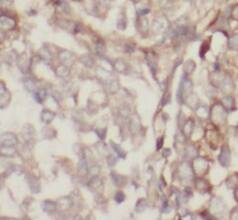 TNFAIP1 Antibody (2H3)