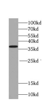 TNFAIP1 Antibody (2H3)