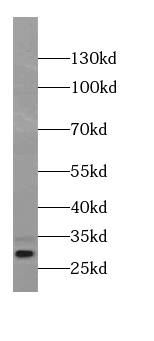 beta B1 Crystallin Antibody (2D8)