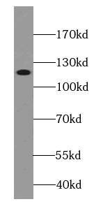 CTAGE1 Antibody (4F3)
