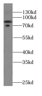 Cullin 4a Antibody (5A7)