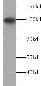 Isopeptidase T/USP5 Antibody (6G1)