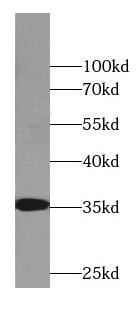 CYB5R3 Antibody (8H0)