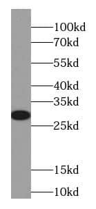 Cytoglobin Antibody (7F6)