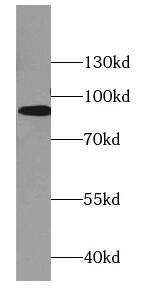 DBC1 Antibody (8C10)