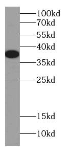 DNAJB2 Antibody (2H8)