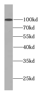 SART2 Antibody (3G11)