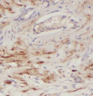 ECHS1 Antibody (1H0)