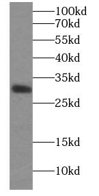 ECHS1 Antibody (1H0)