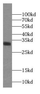 EEF1B2 Antibody (8A11)