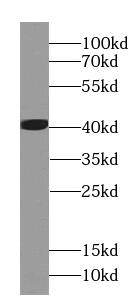 EEF1D Antibody (0H1)