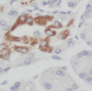 EEF1D Antibody (0H1)
