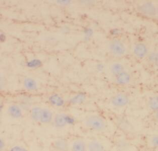 EIF3D Antibody (2D11)