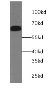 EIF3D Antibody (2D11)