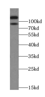 EPLIN Antibody (1D0)
