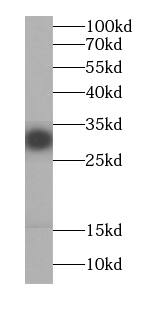 RRP4 Antibody (6E9)