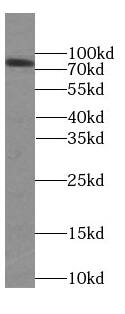 FAF1 Antibody (9H10)