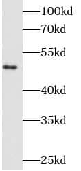 Fibrinogen beta chain Antibody (6F4)