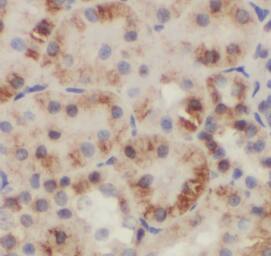 GDI2 Antibody (0B10)