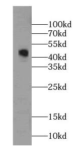 GDI2 Antibody (0B10)