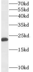 GM2A Antibody (9C9)