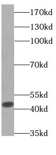 Aspartate Aminotransferase Antibody (2F1)