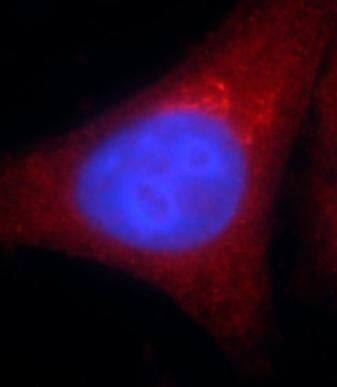 alcohol dehydrogenase 5 Antibody (3E7)