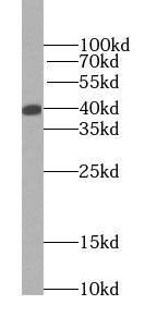 alcohol dehydrogenase 5 Antibody (3E7)